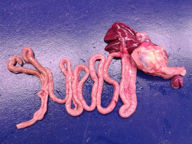 Intestine, normal